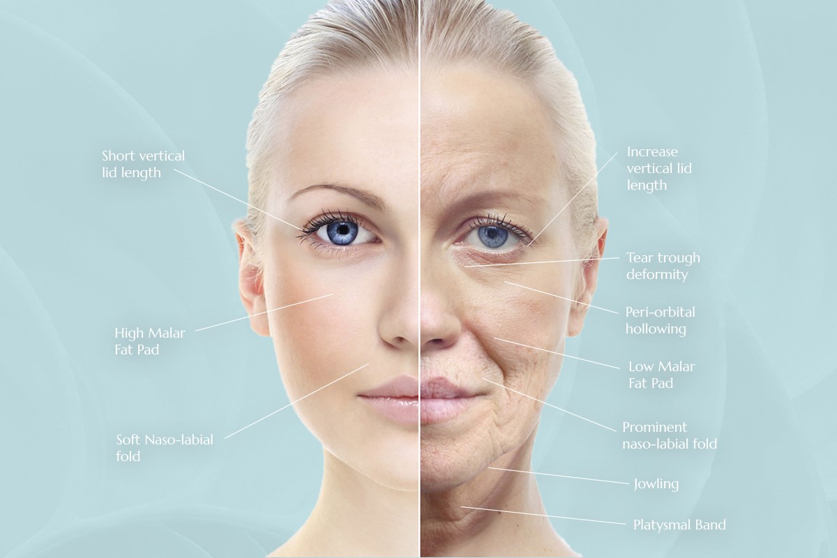 Timeline of facial ageing | River Aesthetics