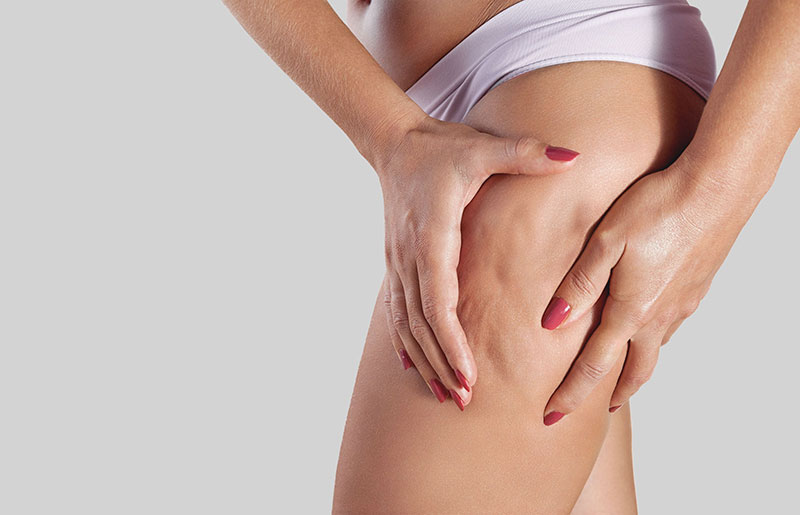 Cellulite – Causes and Treatment  DG Laser & Cosmetic Gynecology Clinic
